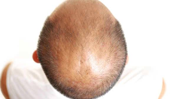 怎么判斷孩子是否有蛔蟲？出現(xiàn)這4種癥狀要及時看醫(yī)生！