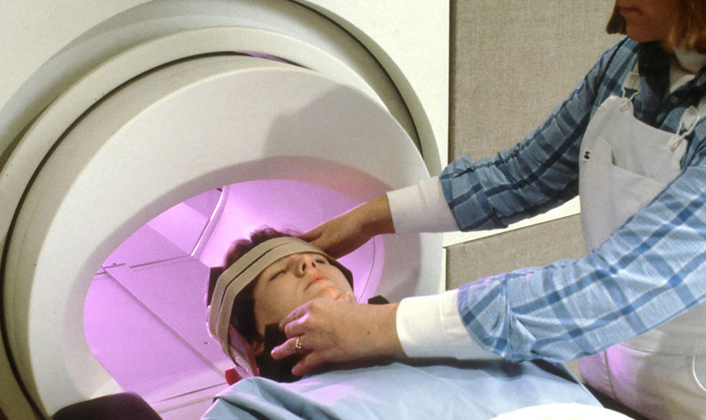 跑步對(duì)祛痘有好處嗎?