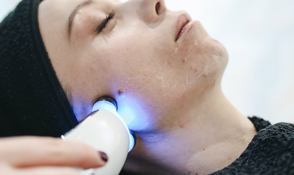 除濕祛痘應該吃什么